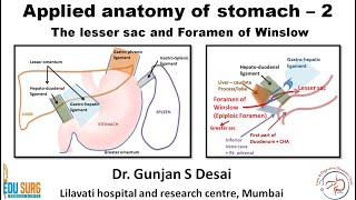 Lesser sac and foramen of Winslow  Applied anatomy of stomach part 2 [upl. by Freyah]