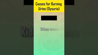 Causes for Burning Urine  Dysuria [upl. by Botzow15]