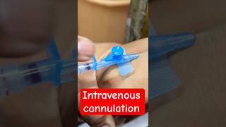 Intravenous iv Cannulation  trending hospital cannula doctor SMpharmacy subscribe [upl. by Onibas]