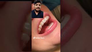 What to do after orthodontic treatment Retainers  Fixed  trending hospital dentalschoollife [upl. by Eimiaj383]