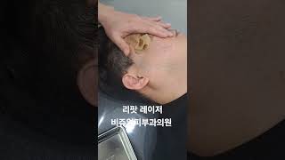 리팟 레이저 다발성 흑자 세종리팟 세종시리팟 reepot lentigo multiplelentigo 청주리팟 공주리팟 대전리팟 오창리팟 오송리팟 부여리팟 [upl. by Ylim665]