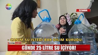 Günde 25 litre su içiyor [upl. by Northington]