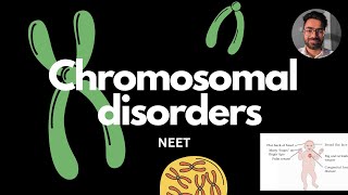 Chromosomal disorders  Down klinefelter turner syndrome genetics neetug [upl. by Aurore]