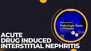 Acute drug induced interstitial nephritis  Causes Pathogenesis  Morphology  Clinical features [upl. by Riti701]