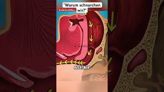 Warum schnarchen wir [upl. by Liam60]