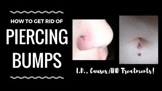 Piercing Bumps 101 Identification and Treatments [upl. by Atinehc]