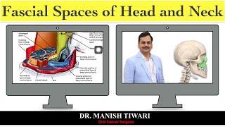 Odontogenic space infection part2  fascial spaces of head and neck [upl. by Grunenwald542]