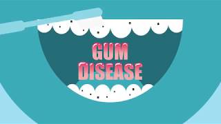 Wave goodbye to gum disease with Listerine® [upl. by Anigroeg]