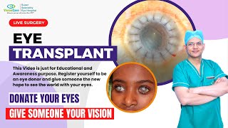 LIVE Eye Transplant  Cornea Transplant  How Eye Donation help someone to see  नेत्रदान महादान [upl. by Delly154]