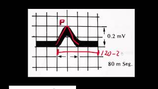 CURSO DE ELECTROCARDIOGRAFIA 14  UN CICLO CARDÍACO EXPRESADO EN TÉRMINOS ELÉCTRICOS NOMENCLATURA [upl. by Aneroc769]