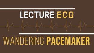 Interprétation ECG  Wandering Pacemaker [upl. by Amsaj746]