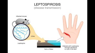 Understanding Leptospirosis Symptoms and Treatment  Expert Guide [upl. by Adalheid]