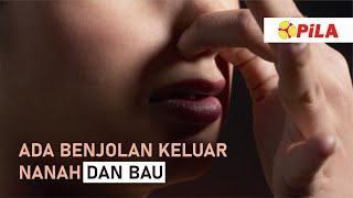 ada benjolan keluar nanah dan bau 🤢🤢 [upl. by Iturk]