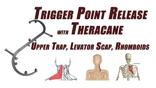 Trigger Point Release in the Upper Trapezius Levator Scapulae and Rhomboids Using a Cane Device [upl. by Barbabra]