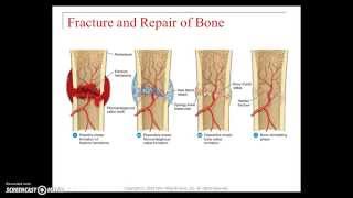 Skeletal system diseases and disorders [upl. by Devehcoy667]