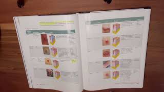 Milady Cima Standard Esthetics Chapter 4 Disorders and Diseases of the Skin [upl. by Ailuj983]