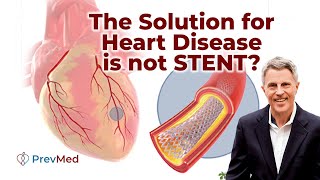 This is Why Stent is Not Always The Solution for Heart Disease [upl. by Coffin]