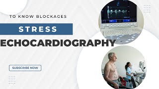 Stress echo test  Stress echocardiography [upl. by Idak]