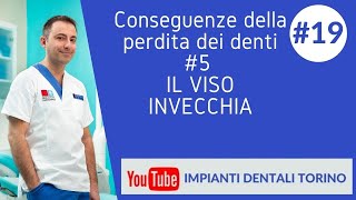 IL VISO INVECCHIA CONSEGUENZA DELLA PERDITA DI DENTI IMPIANTI DENTALI TORINO [upl. by Herculie]