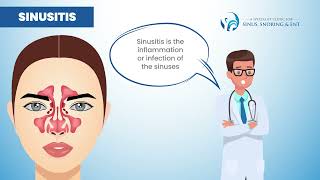 Sinus Rhinitis amp Sinusitis Explained [upl. by Cahilly]