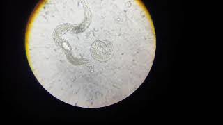 Plant parasitic Nematodes of apricotAphelenchus avenae p2 [upl. by Arias]