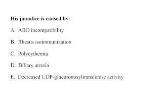 Neonatology MCQ 121 jaundice [upl. by Alberto516]