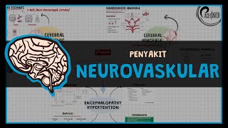 STROKE Cerebral Ischemic Cerebral Hemorrhage amp Encephalopathy Hipertension NEUROVASCULAR DISEASE [upl. by Kcirnek]