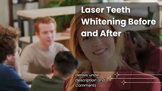 Laser Teeth Whitening Before and After [upl. by Laraine]