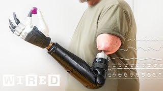 How MindControlled Bionic Arms Fuse To The Body  WIRED [upl. by Squier538]