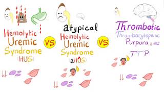 HUS vs aHUS vs TTP [upl. by Auerbach]