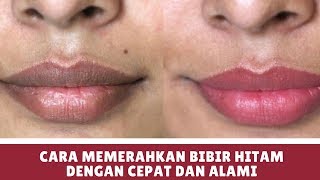 Cara Memerahkan Bibir Hitam Dengan Cepat dan Alami [upl. by Rudelson]