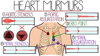 Learn Heart Murmurs In 10 Minutes With Heart Murmur Sounds [upl. by Niall414]