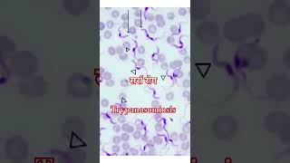 Trypanosoma [upl. by Iru]