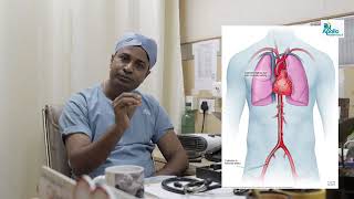 what is CORONARY ANGIOGRAPHY youtube shortvideo viralvideo Srabonidas daily shorts [upl. by Amairam]