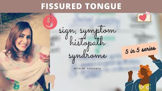 fissured tongue I oral pathology lectures [upl. by Sharpe]