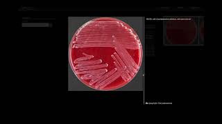 Lipohylic Test  Microbiology [upl. by Odnumyar]