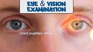 Examination of the Eyes and Vision  OSCE Guide old version  UKMLA  CPSA [upl. by Uel]