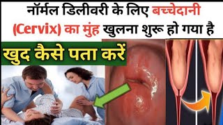 9वे महीने में बच्चेदानी का मुंह खुलने के लक्षण  SYMPTOMS OF CERVIX OPENINGCervix opening symptoms [upl. by Rafael384]