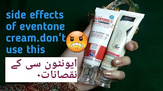 eventone c cream honest review  dont use it [upl. by Eshman847]