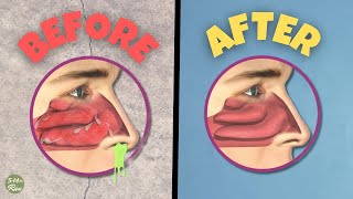 What Causes Phlegm Mucus Ear WAX and Nose Snot  Fascinating Anatomy [upl. by Jehial]