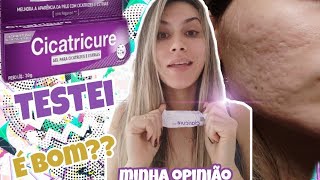 CICATRICURE MINHA OPINIÃO  cicatriz de acne Luara Kelly [upl. by Nnylirak]