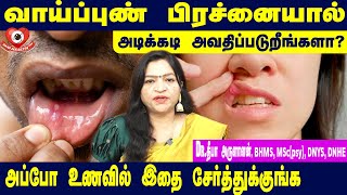 அடிக்கடி வாய்ப்புண் பிரச்னையால் அவதிப்படுறீங்களா  Dr Deepa Arulalan Tips for Mouth Ulcer [upl. by Leonerd729]