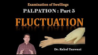 Palpation of Swellings  Part 5  Fluctuation [upl. by Netram]