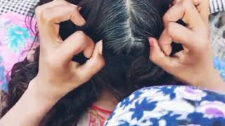 Bugs And Nits Checking ASMR Video  Scalp Checking  Relaxing Head Checking [upl. by Lorrad]