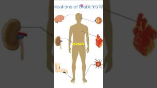 Quick Guide to Balanitis balanitis urology surgeryday medicalshorts medstudentlife doctor [upl. by Angus390]