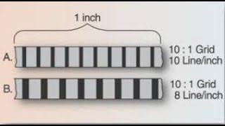 Lecture  Radiographic Grids  Radiographic Physics [upl. by Darryn]