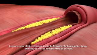 Lactobacillus plantarum INDUCIA [upl. by Xirtaeb474]