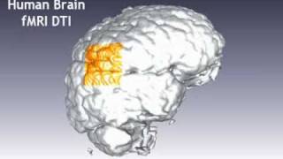 Human Brain Magnetic Resonance  Diffusion Tensor Imaging [upl. by Rasecoiluj]