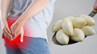 Incredible It KILLS hemorrhoids without surgery Cure swollen hemorrhoids in just one day [upl. by Drofub535]