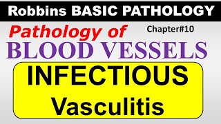 Ch10  INFECTIOUS VASCULITIS  Blood Vessel Pathology  Robbins Lectures [upl. by Brasca924]